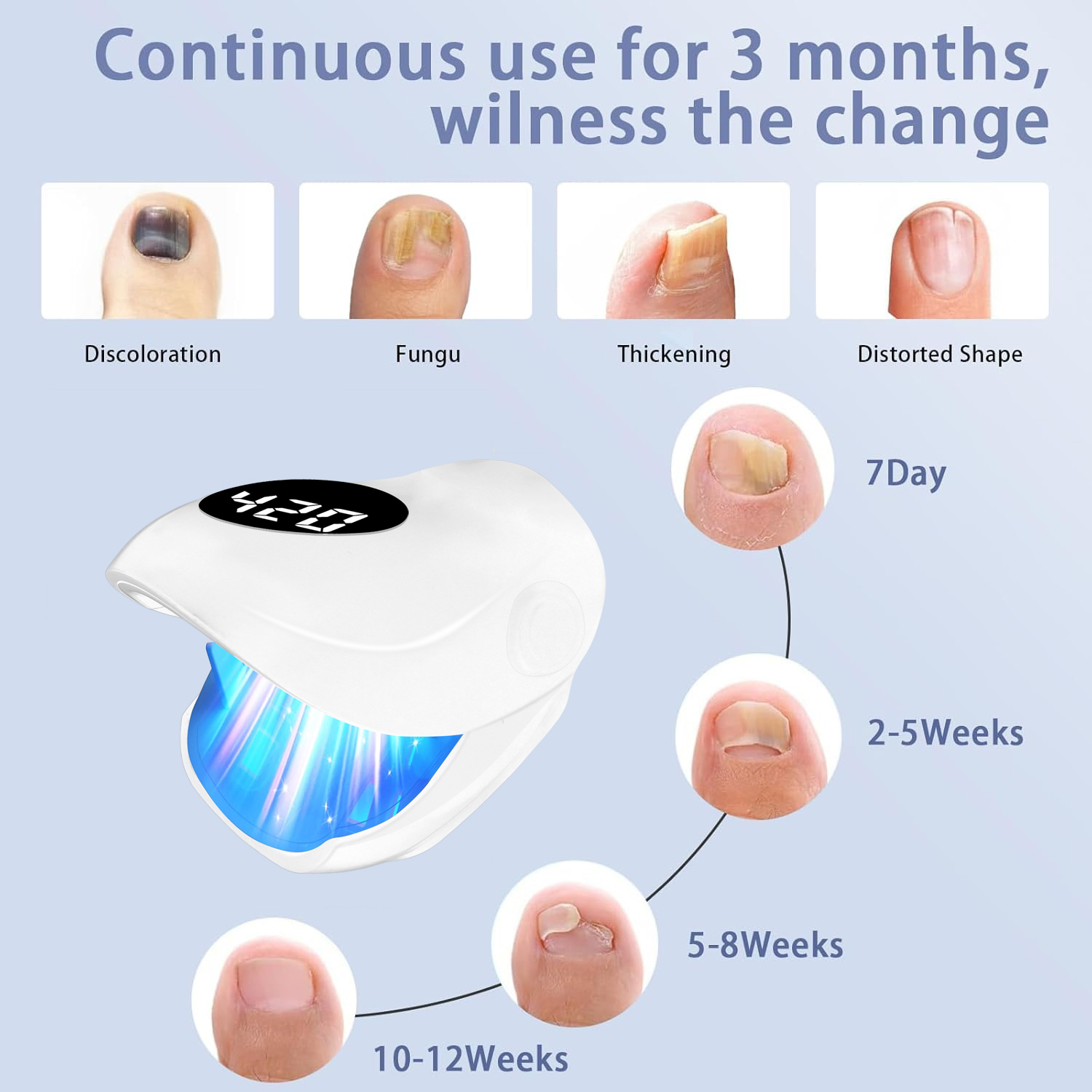 Dispositivo láser para hongos  - Galvanic Skin Sensor reseña y precio